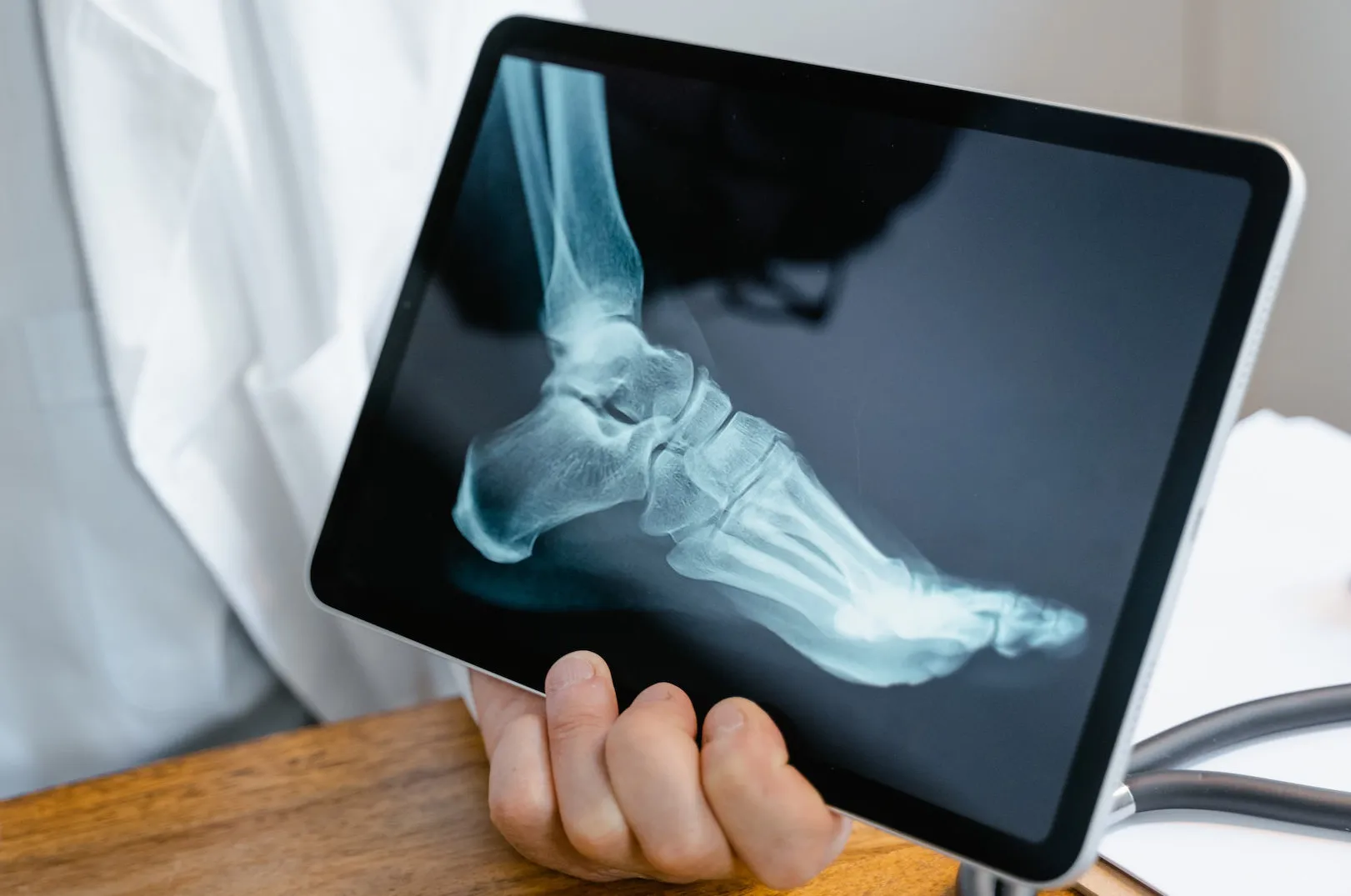 Foot x-ray showing the bones